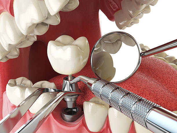 Best Urgent Tooth Repair  in Bristow, OK